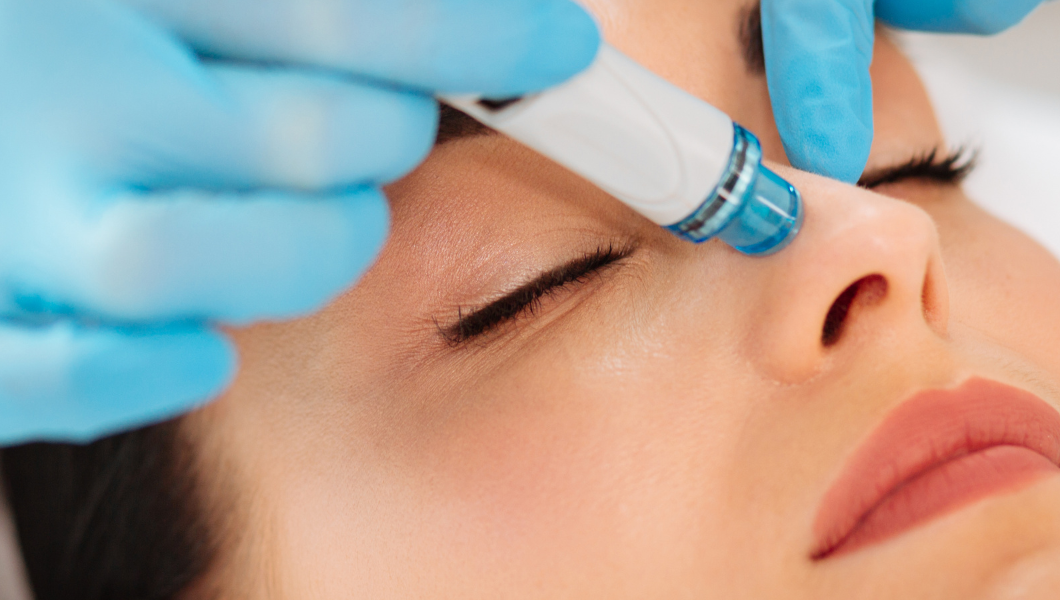 HYDRAFACIAL®: The key to radiant and revitalized skin